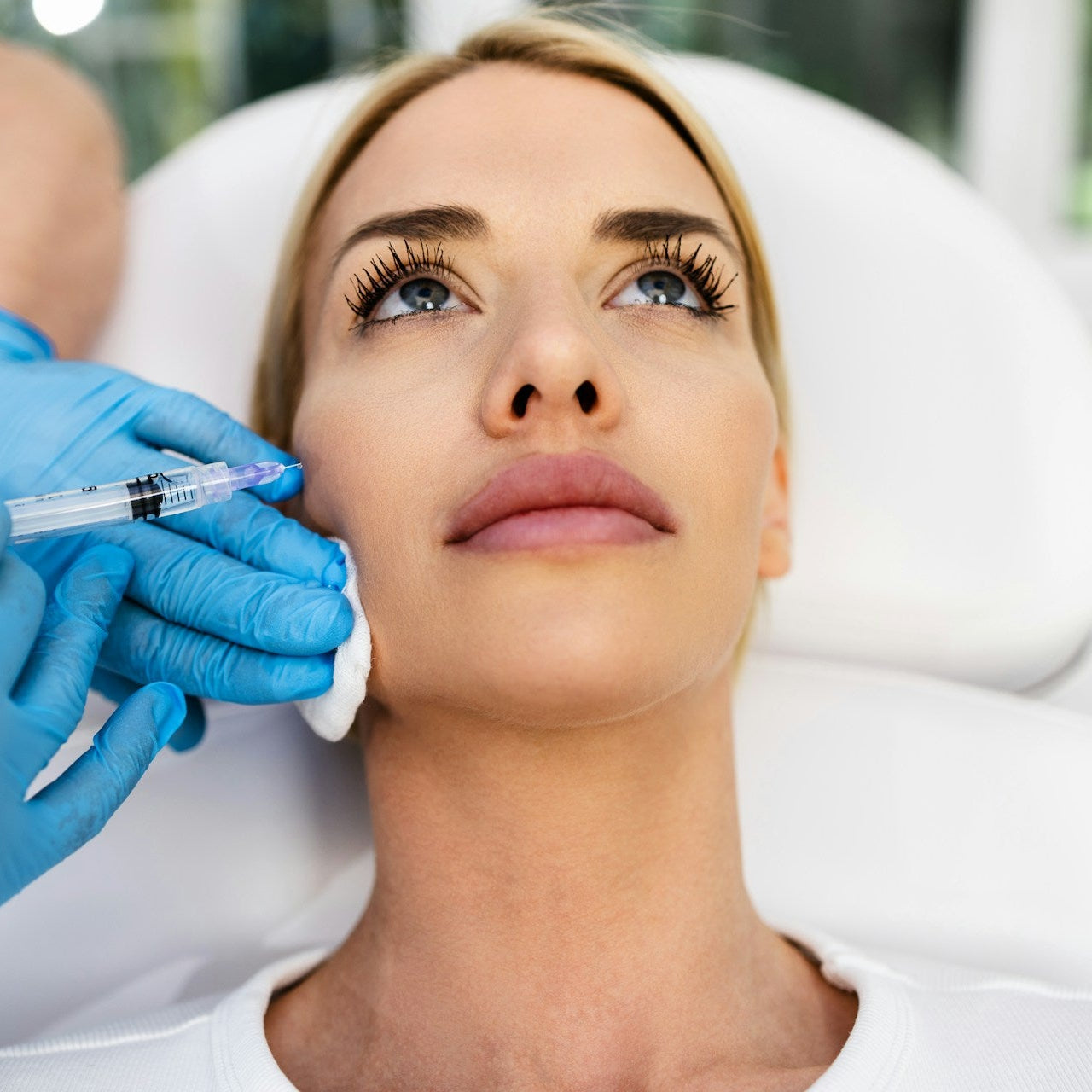 Cheek Filler Treatment Image 1