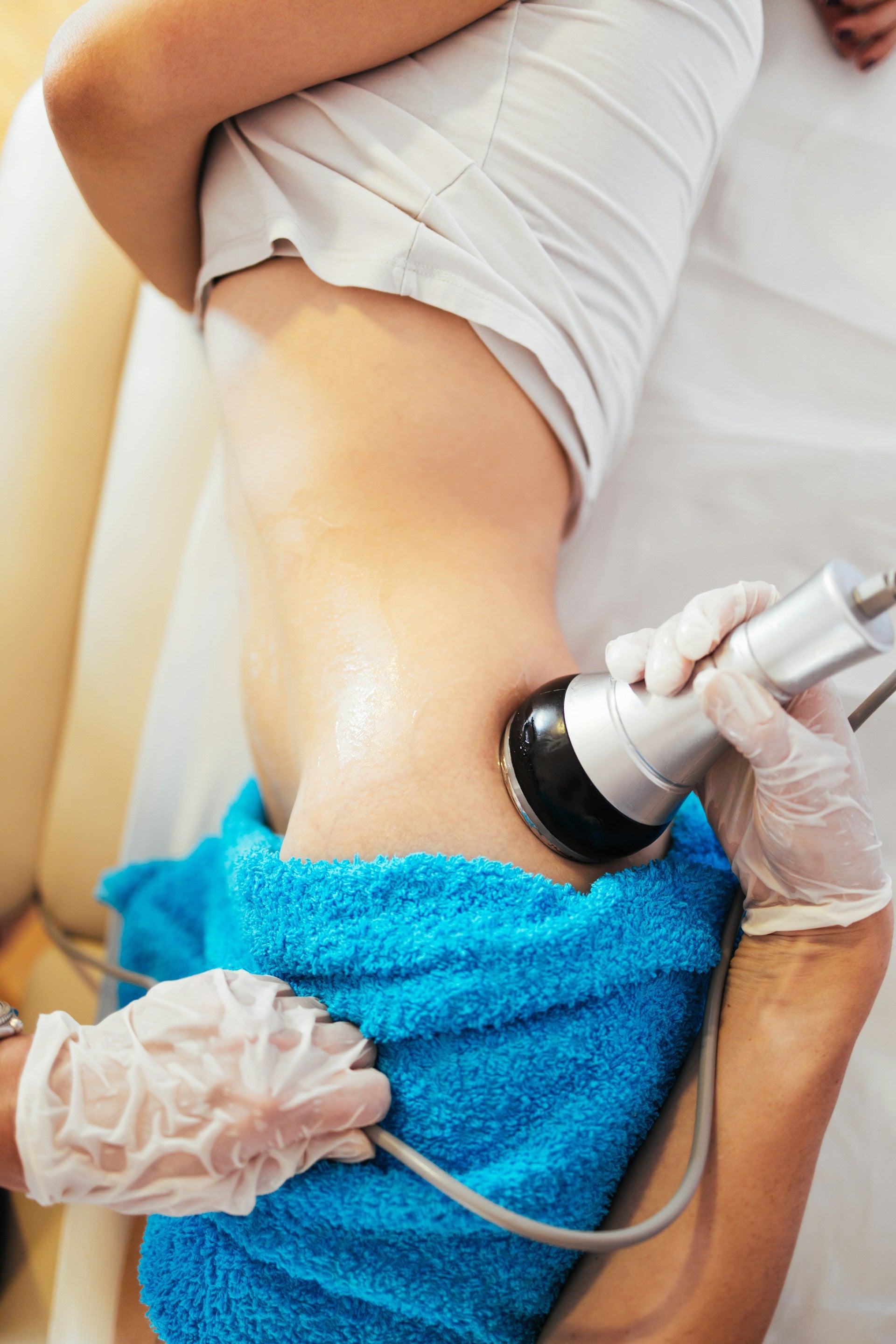 Cryolipolysis Fat Freezing Treatment