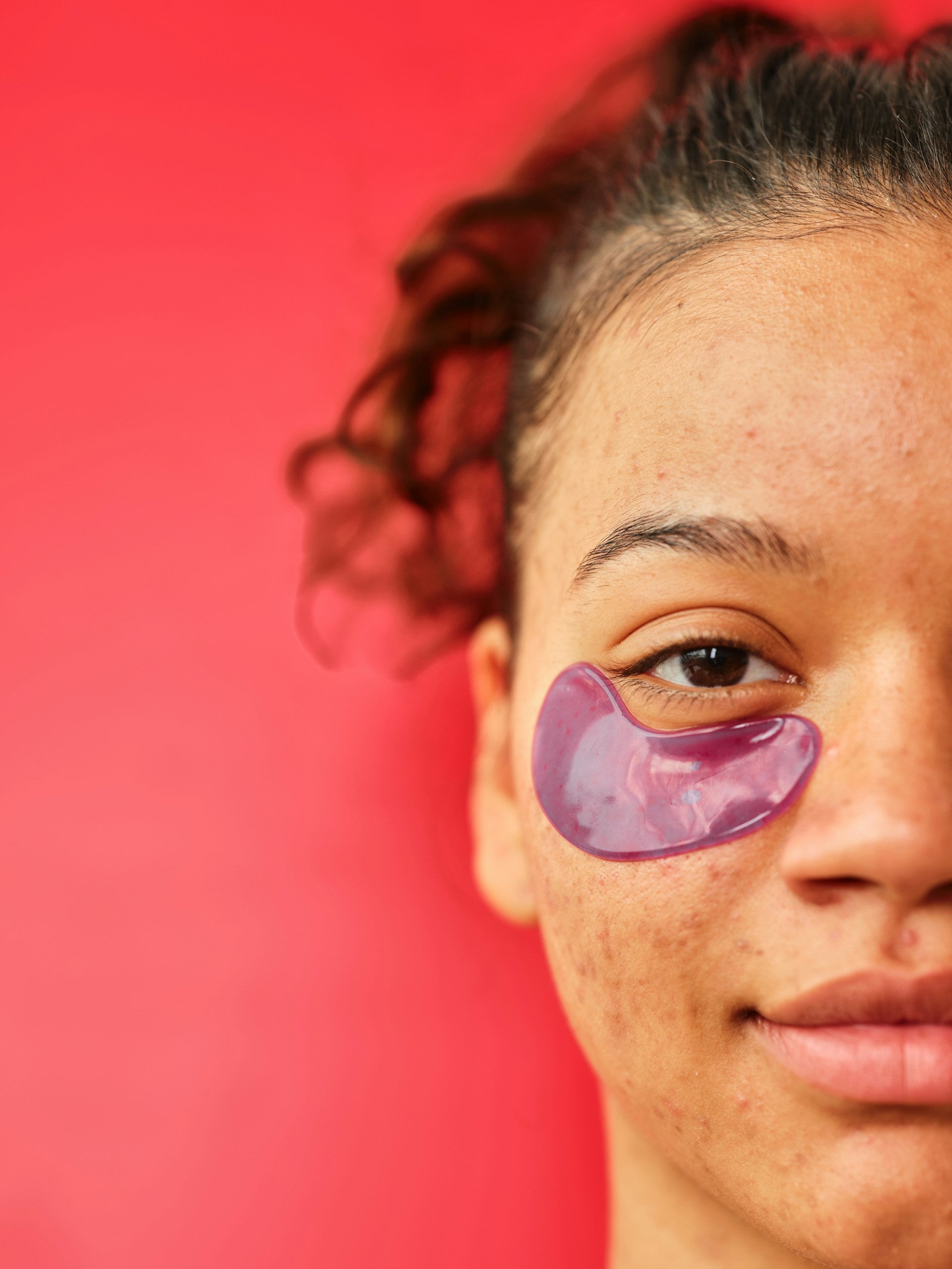Dark Circles Under Eye concerns Image 2