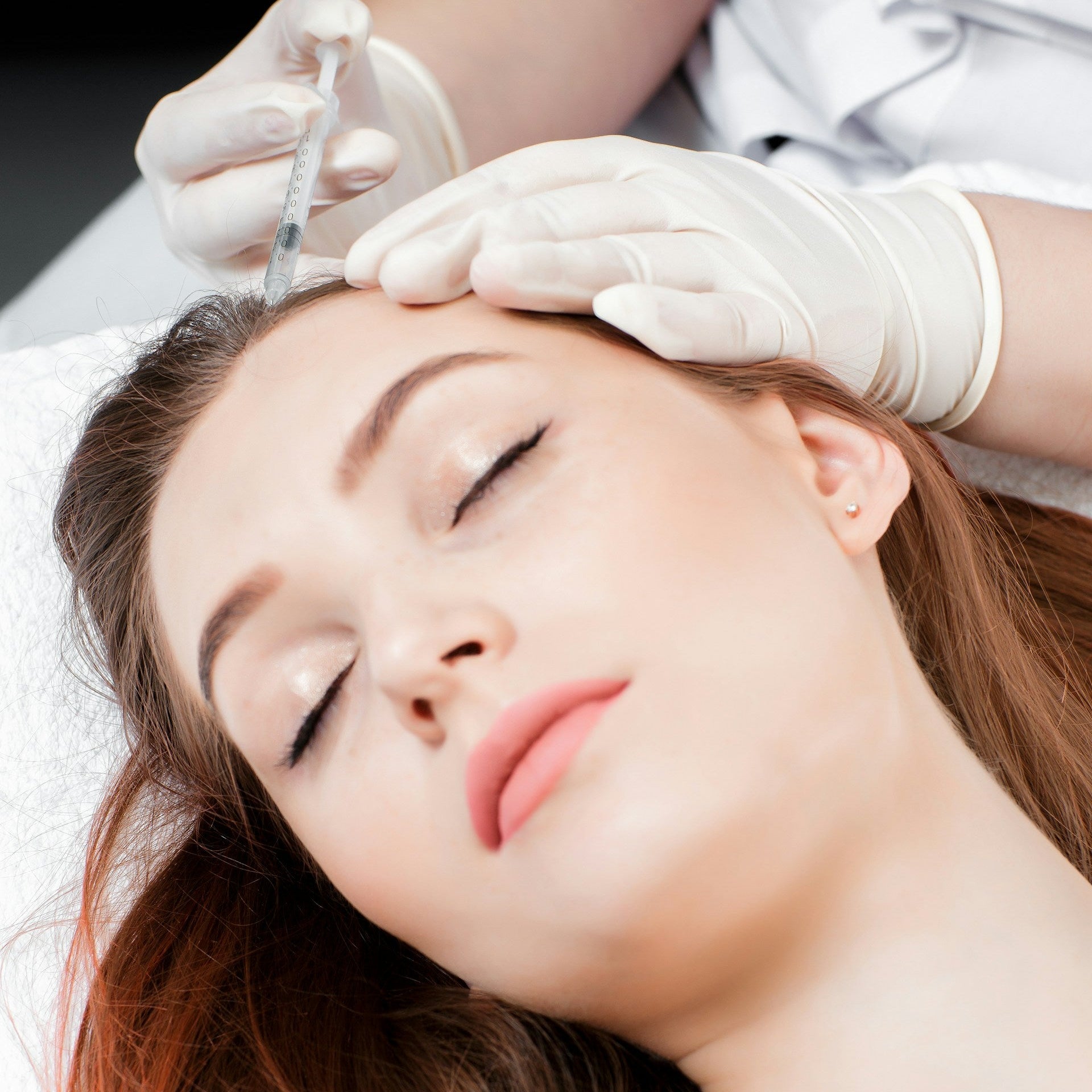 Ellanse Collagen Stimulant treatment Image 1