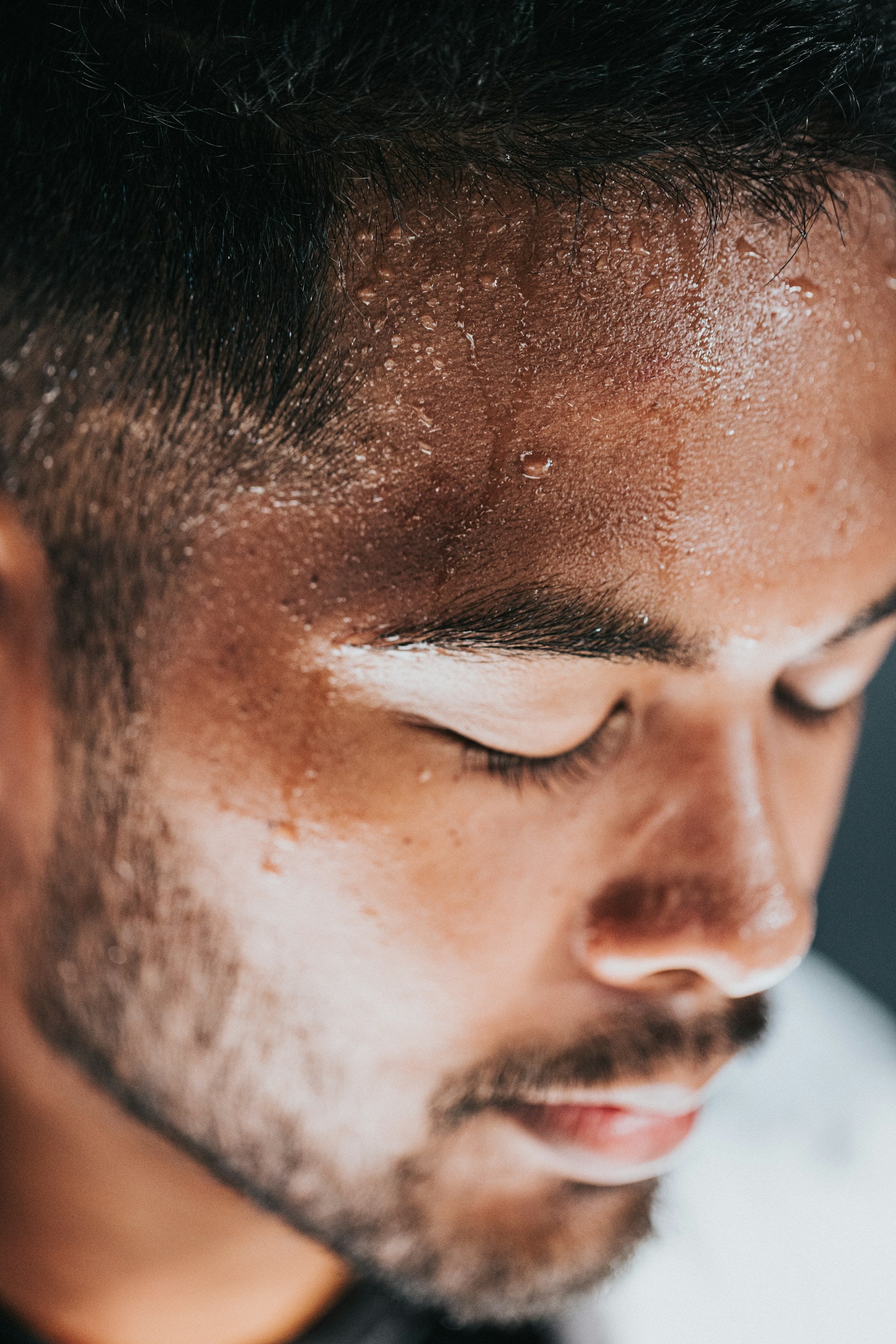 Excess Sweating Hyperhidrosis image 2