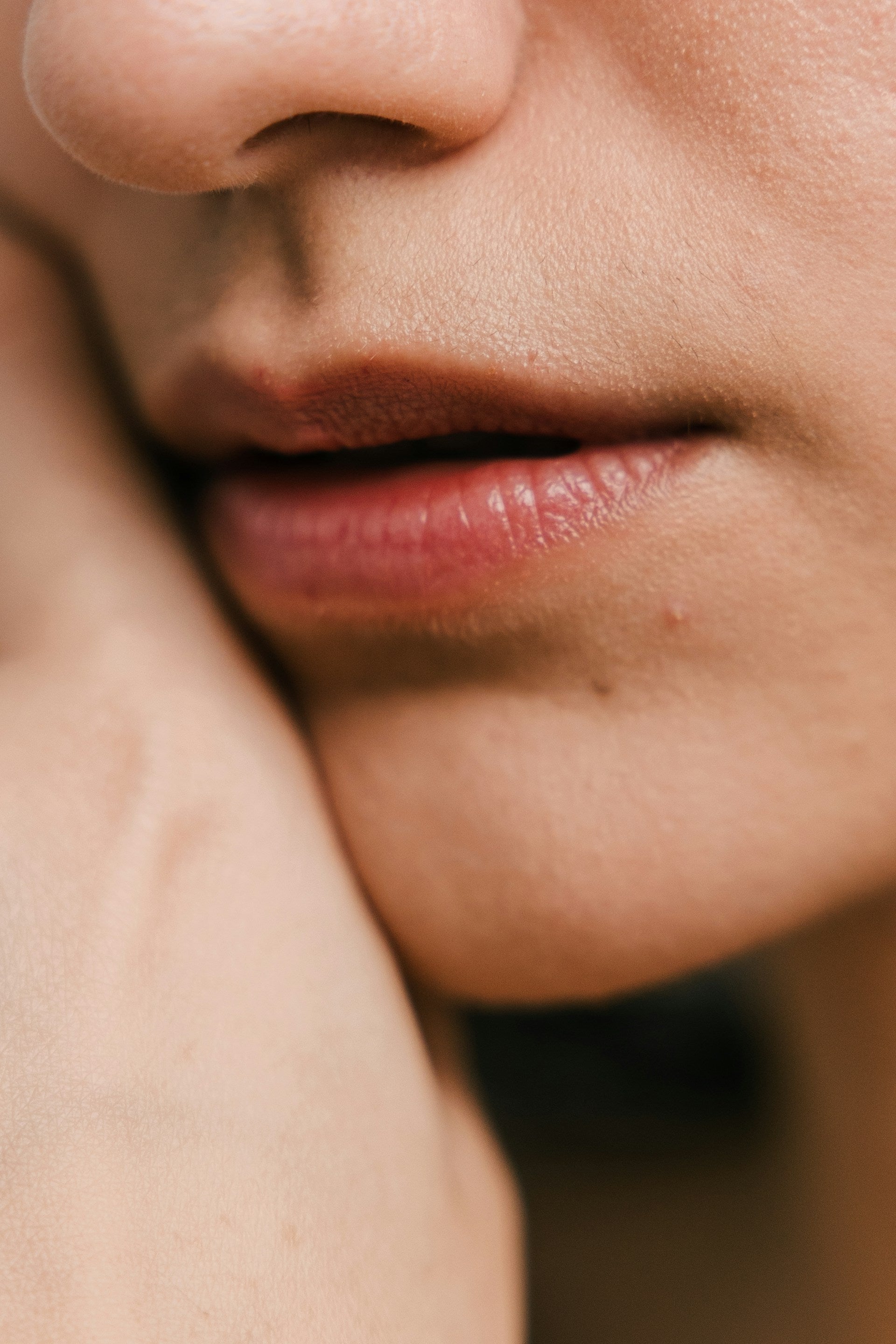 Lip Volume Loss Concern Image 1