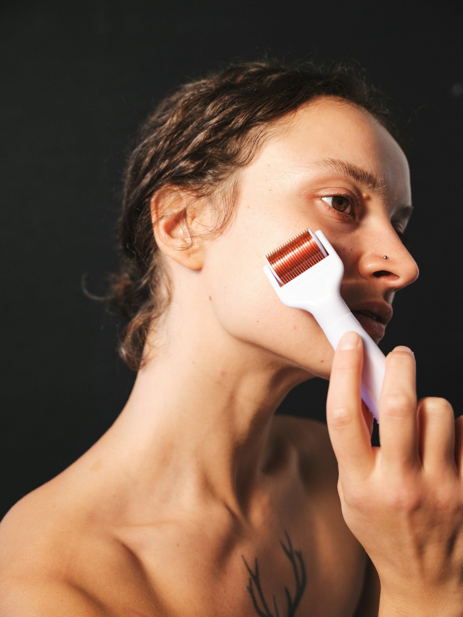 Microneedling treatment