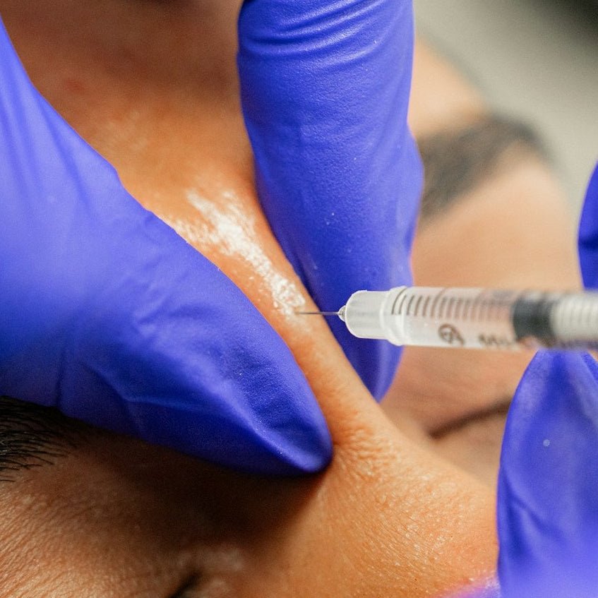 Non Surgical Rhinoplasty Treatment image 1