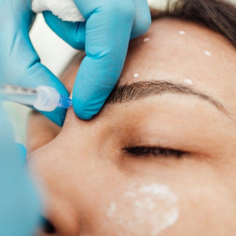 Non Surgical Rhinoplasty Treatment image 3