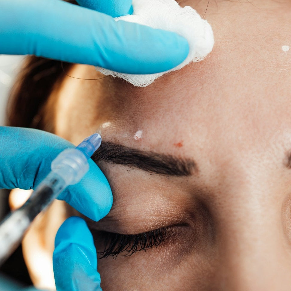 Non Surgical Brow Lift Treatment Image 2