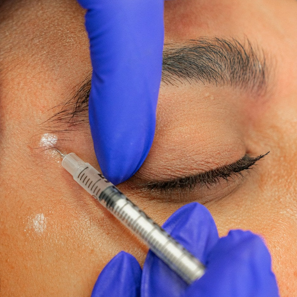 Non Surgical Brow Lift Treatment Image 3