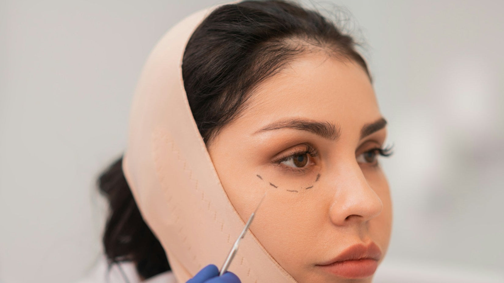 Profiloplasty Profile Balancing Treatment