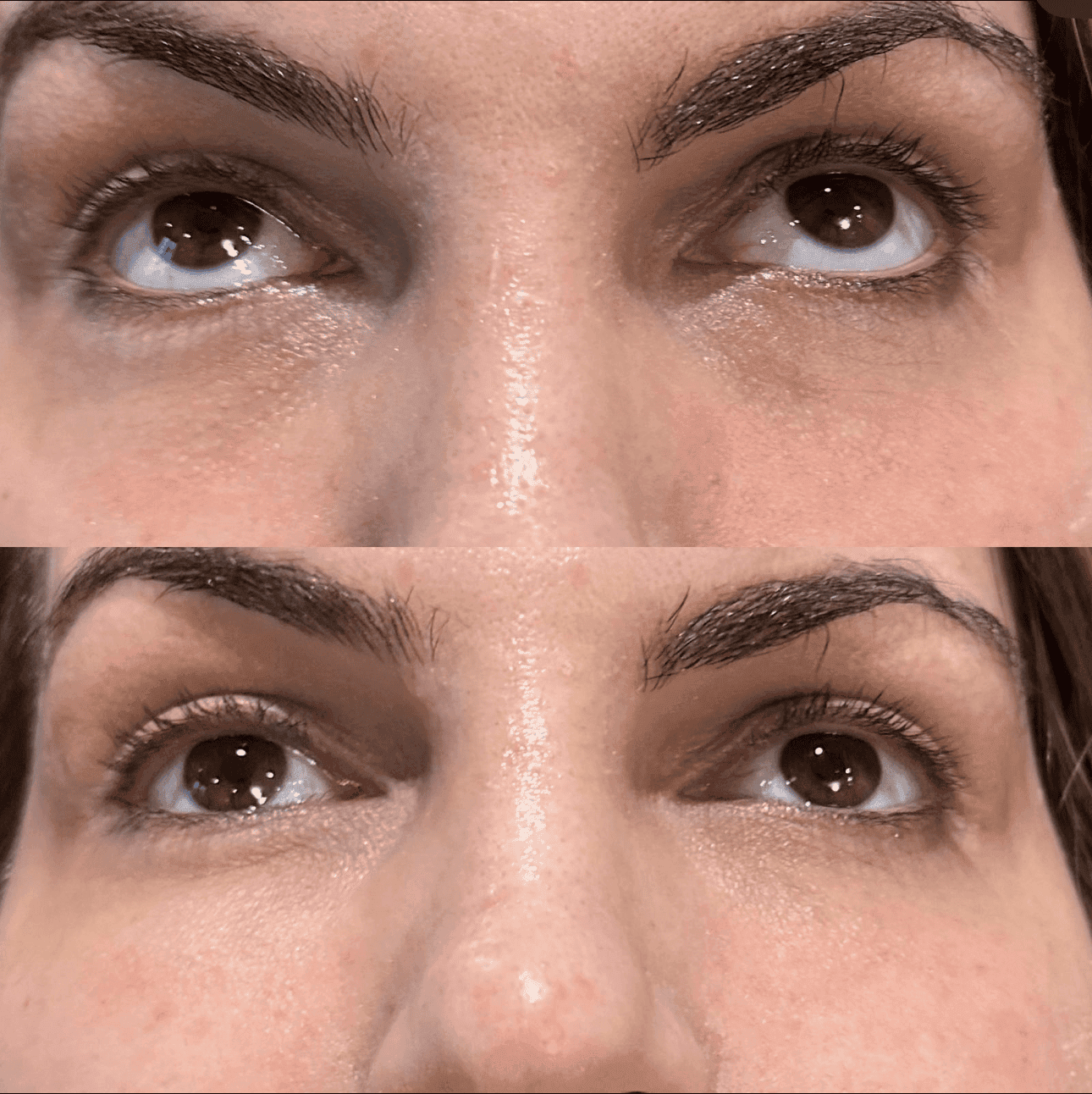 Ameela treatment results Cheshire