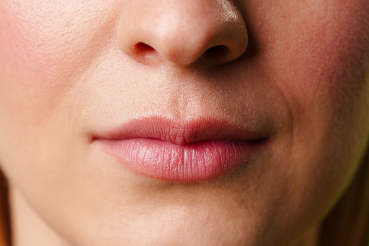 Detailed close-up of a woman’s lips and lower face used to illustrate a lip flip treatment guide
