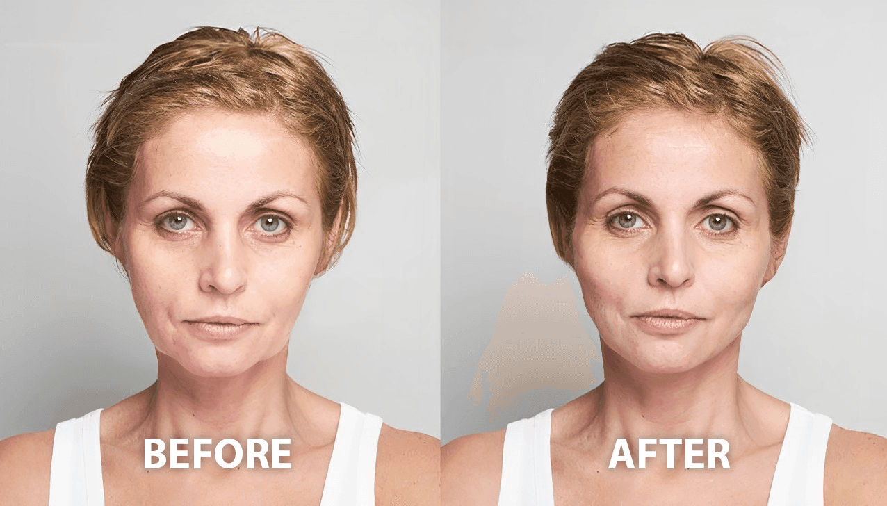 before after woman 2 - normal background
