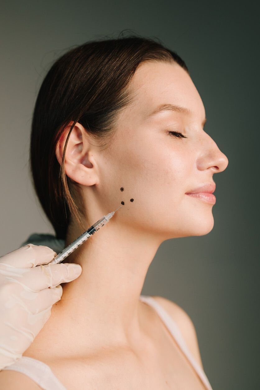 botox for bruxism