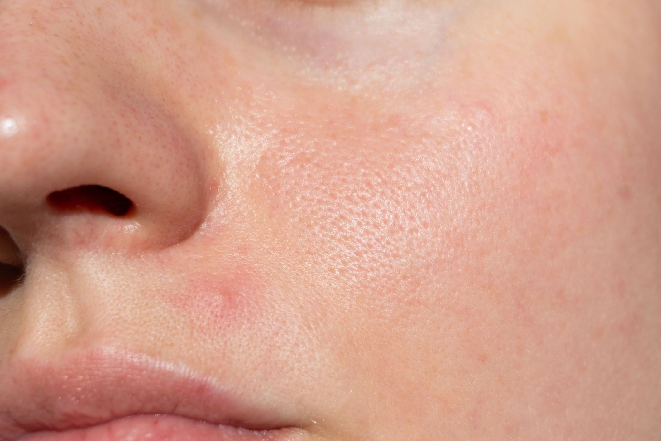 close of skin texture