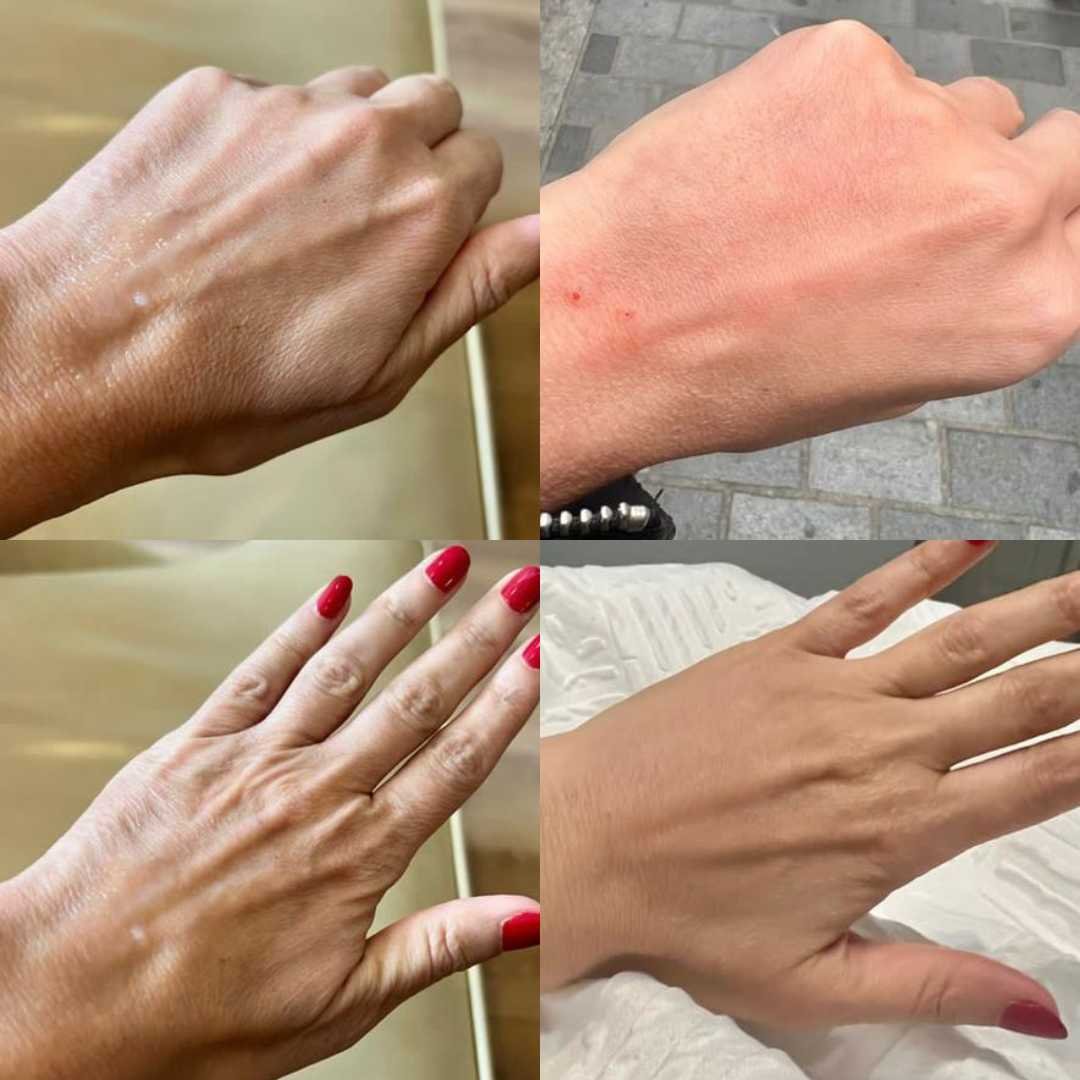hands before and after