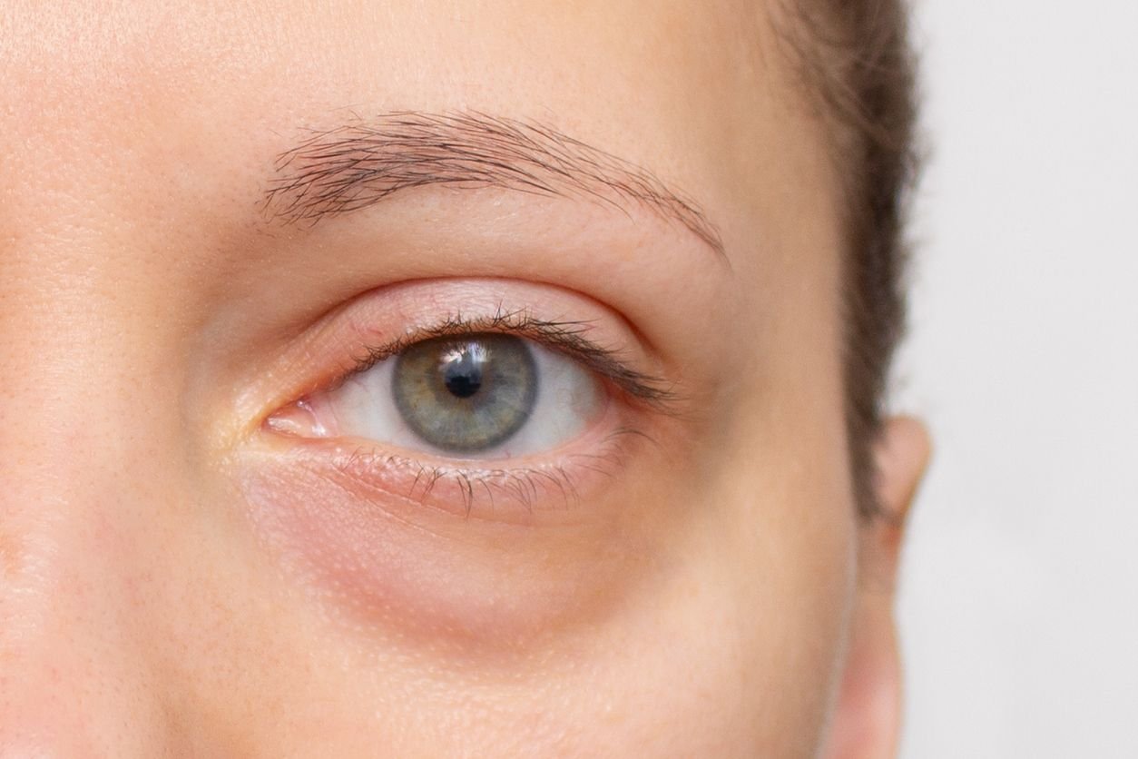 hooded eyes