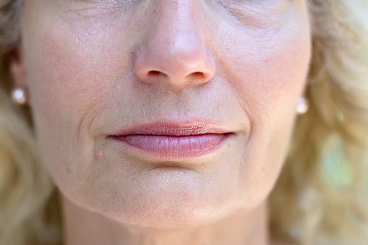 perioral rejuvenation close up