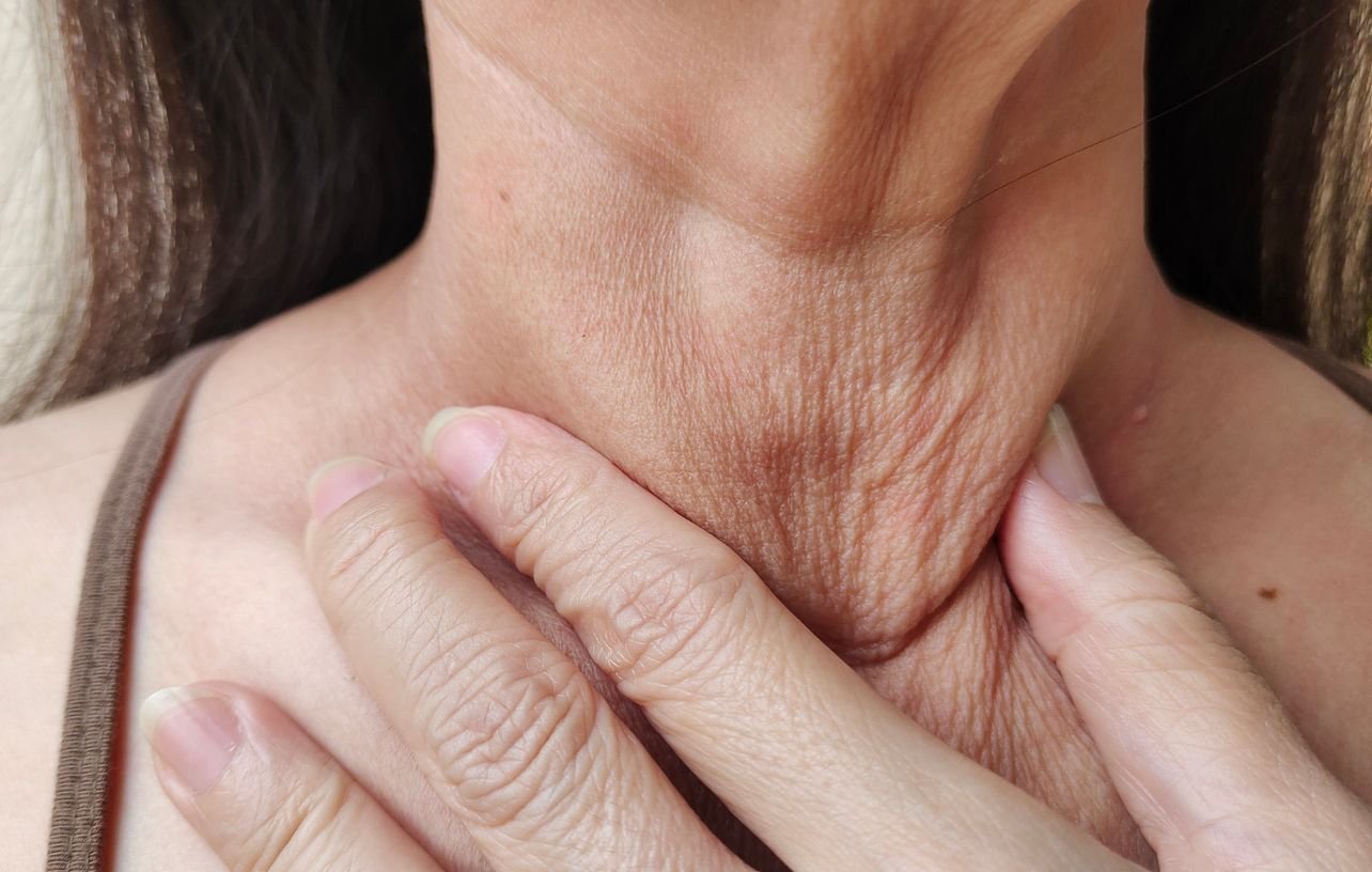 Close-up of mature skin on the neck showing visible wrinkles and fine lines