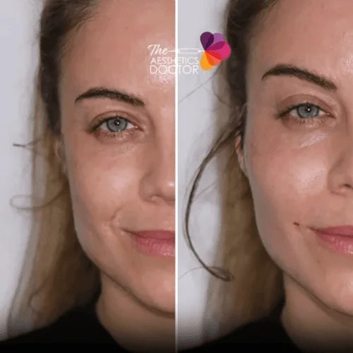 Facial rejuvenation treatments at The Aesthetics Doctor