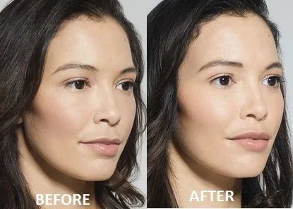 MaiLi Dermal Fillers: The Aesthetics Doctor explains