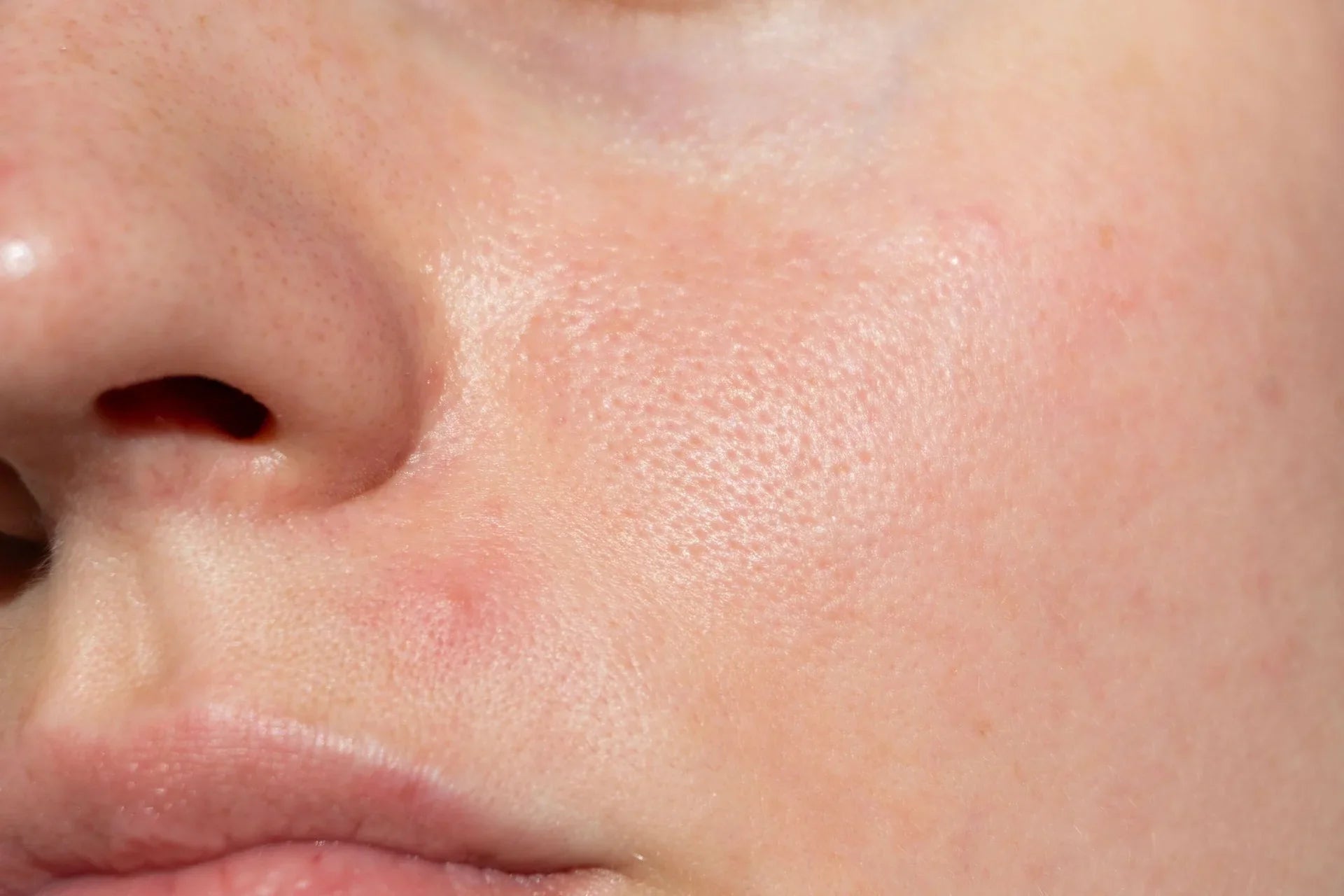 Better skin, no downtime: How EMFACE targets tone and texture