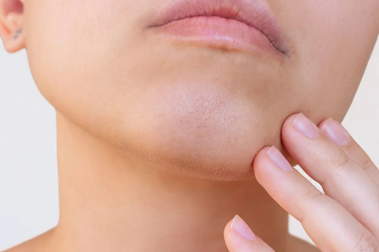 Non-Surgical Chin Augmentation: Subtle Enhancement for a Balanced, Defined Profile
