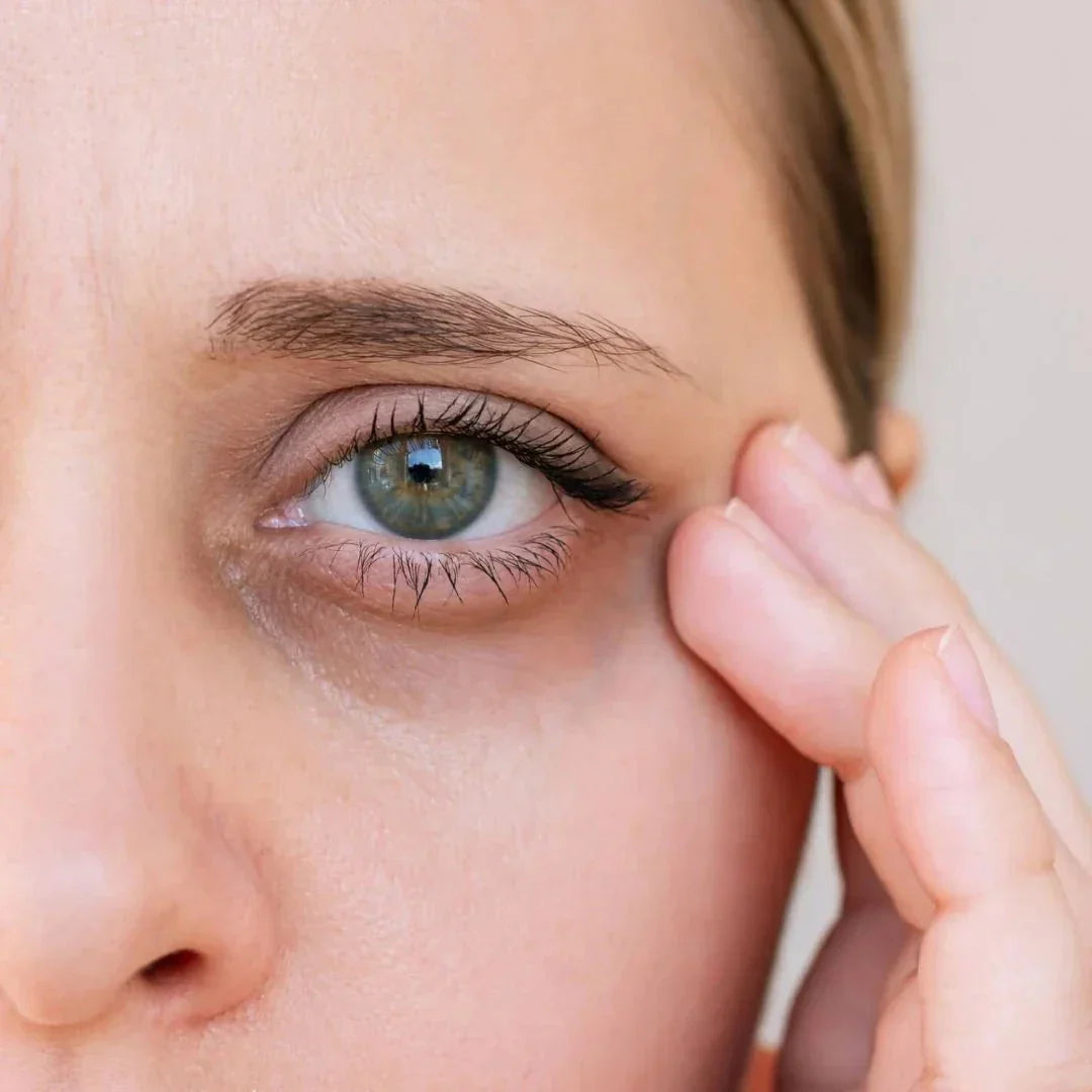 How safe is tear trough filler?