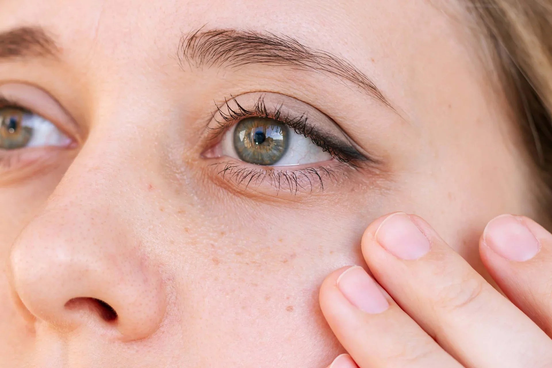How long does tear trough filler last?