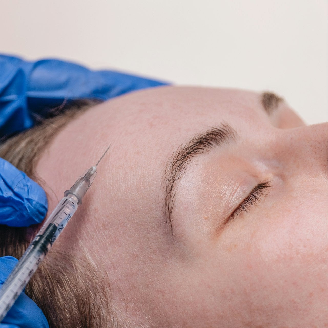 Anti Wrinkle Treatment Image 1