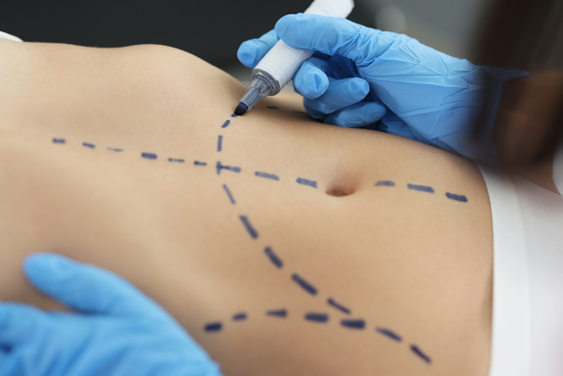 Body Contouring Sculpting Concerns