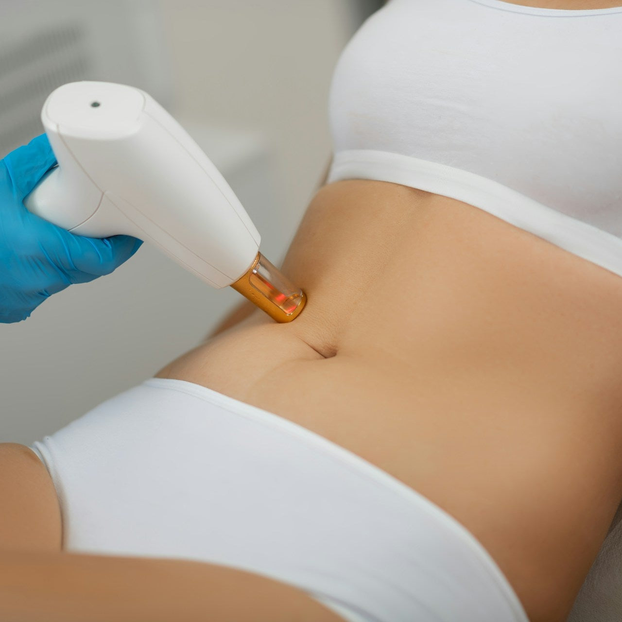 Cellulite Reduction Treatment image 2