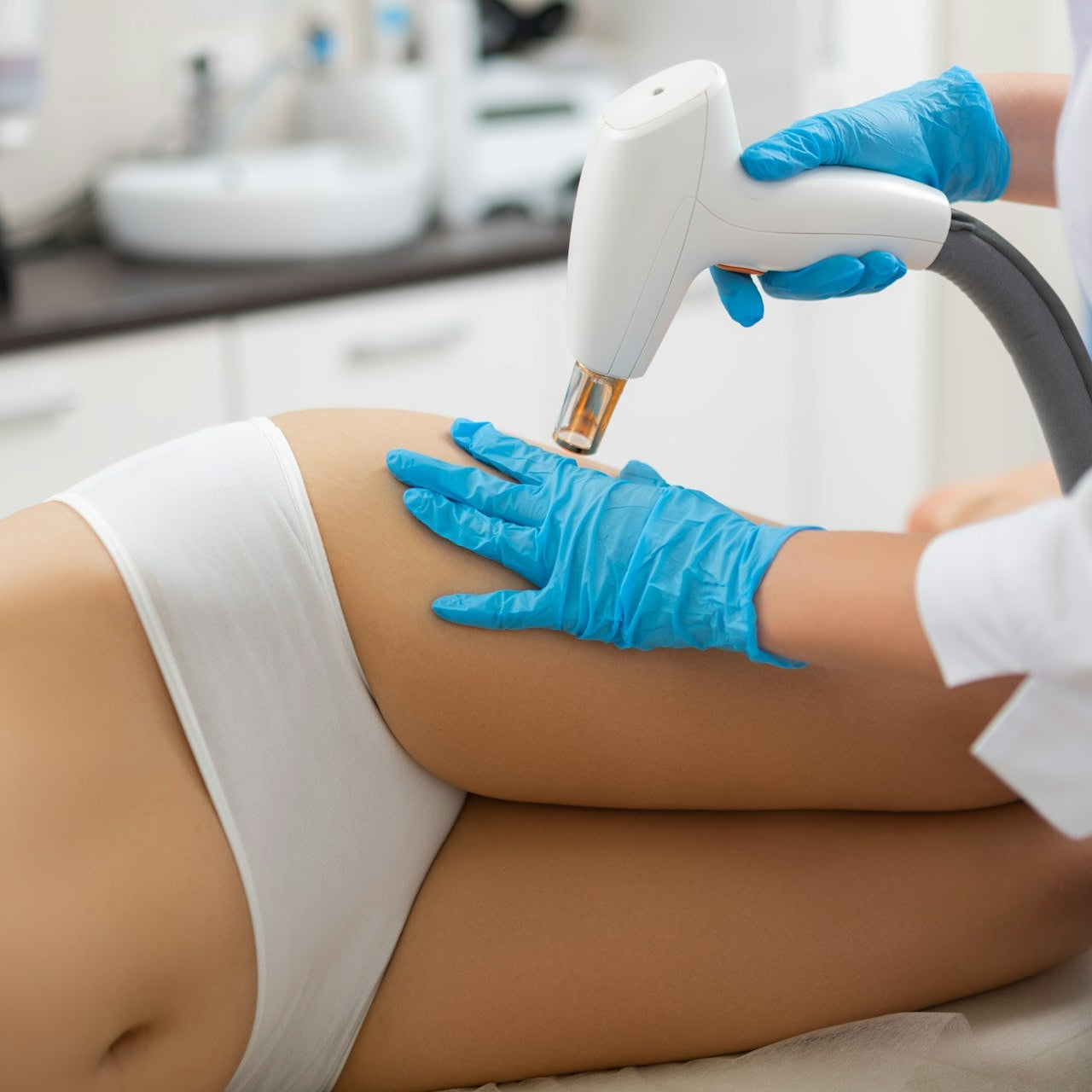 Cellulite Reduction Treatment image 3