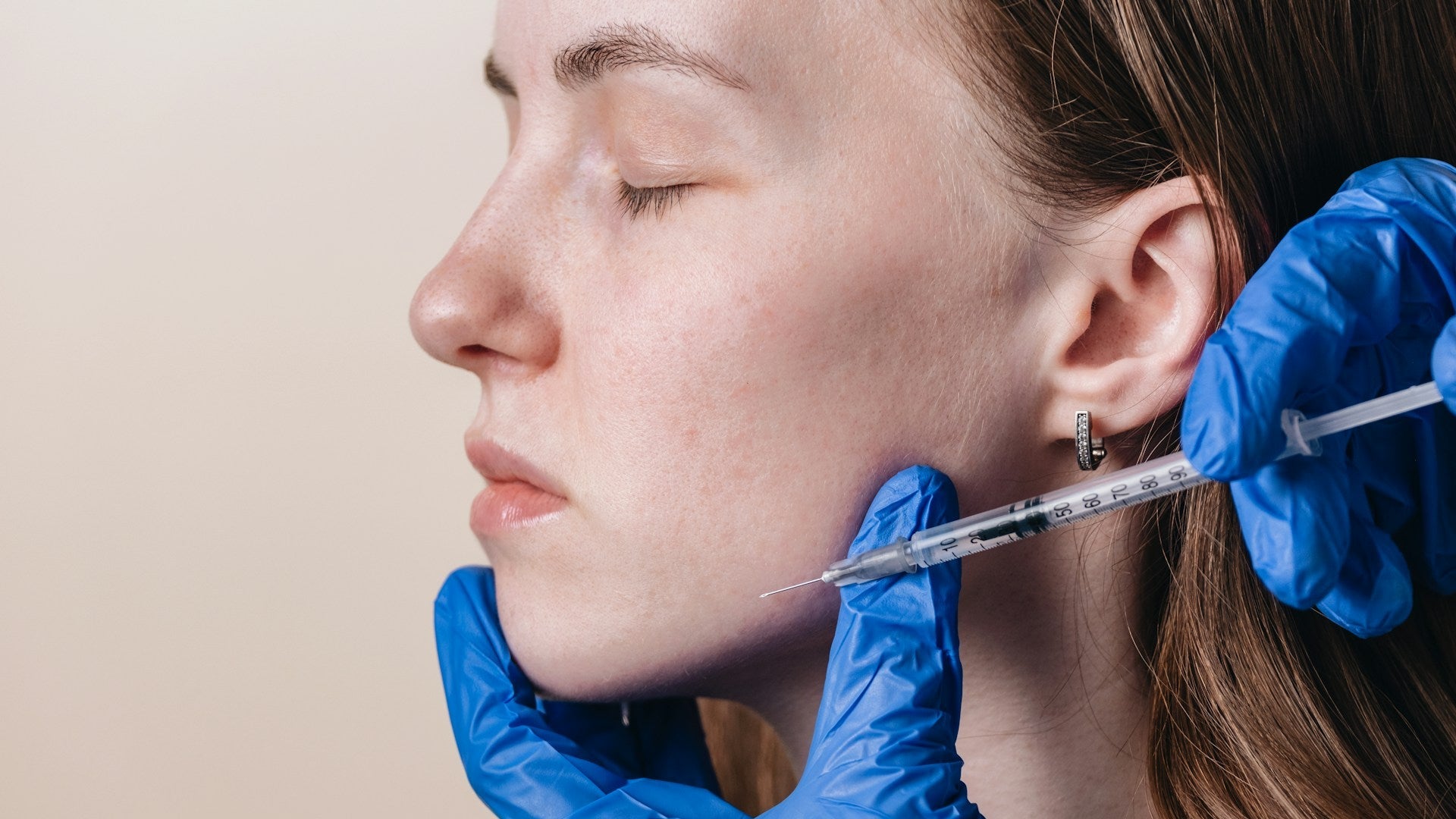 Cheek Filler Treatment