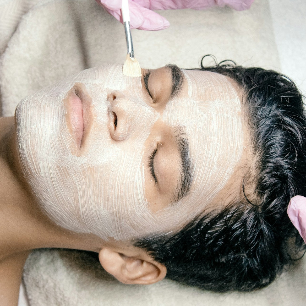 Chemical Peel Treatment image 2