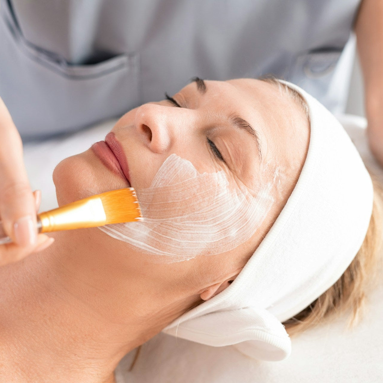 Chemical Peel Treatment image 3