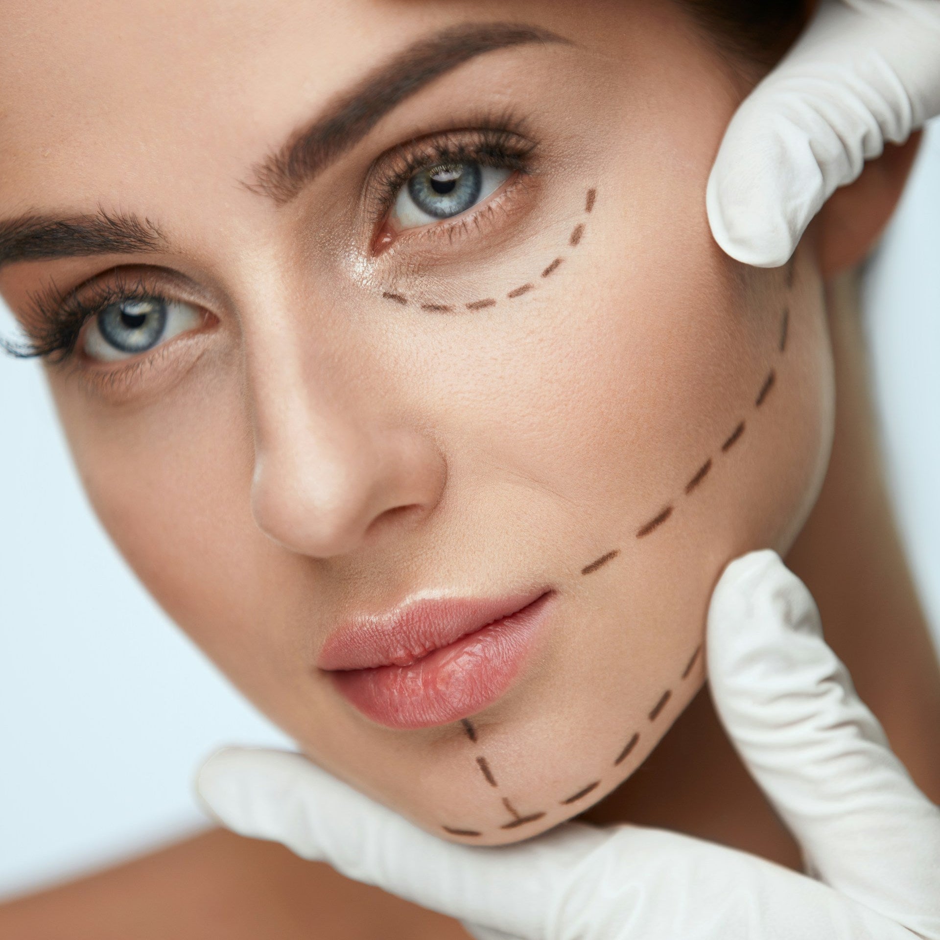 Chin Filler Treatment Image 3