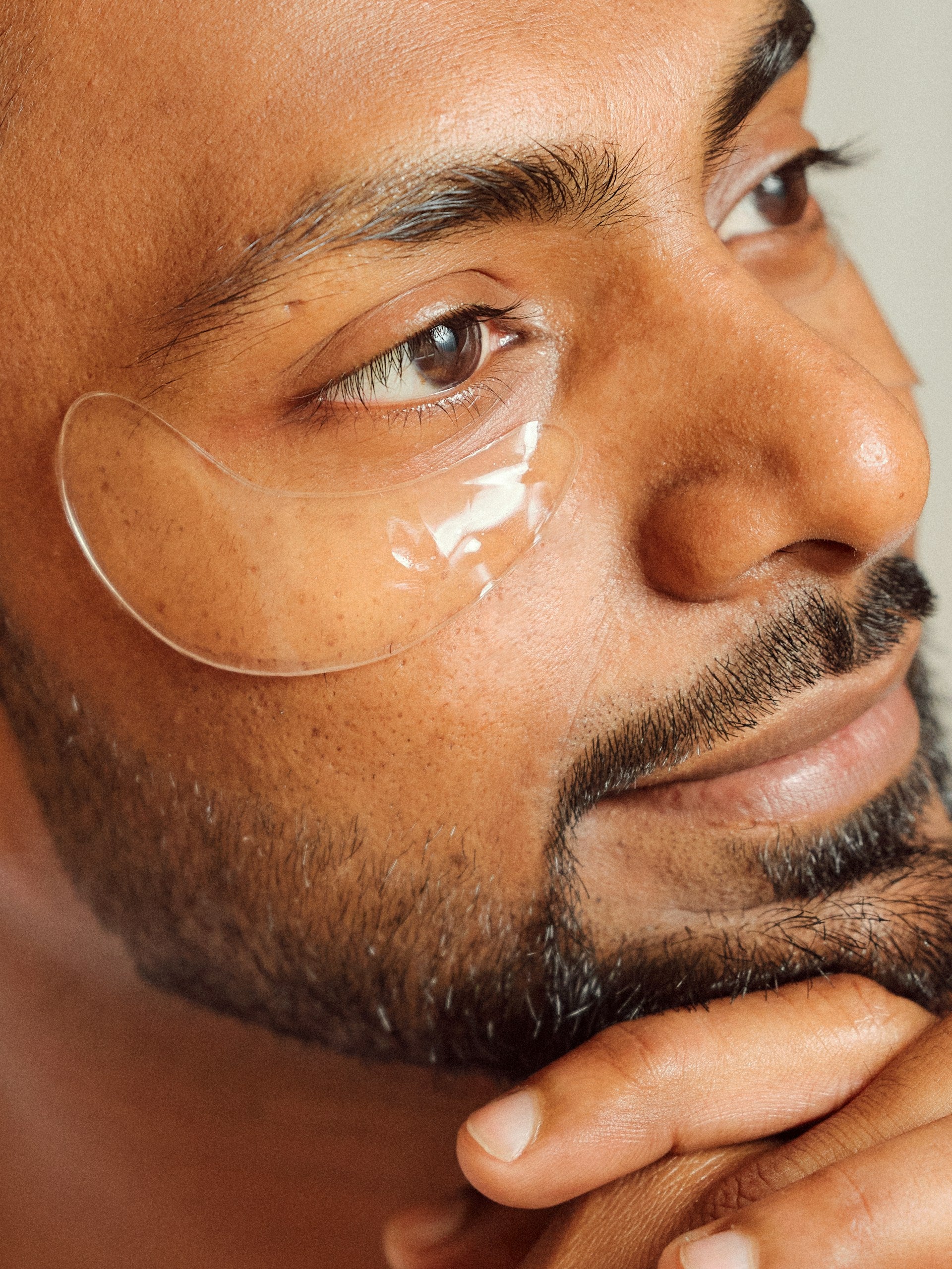 Dark Circles Under Eye concerns Image 1