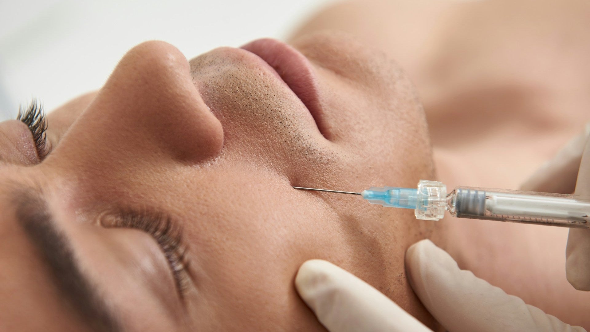 Dermal Filler Treatment