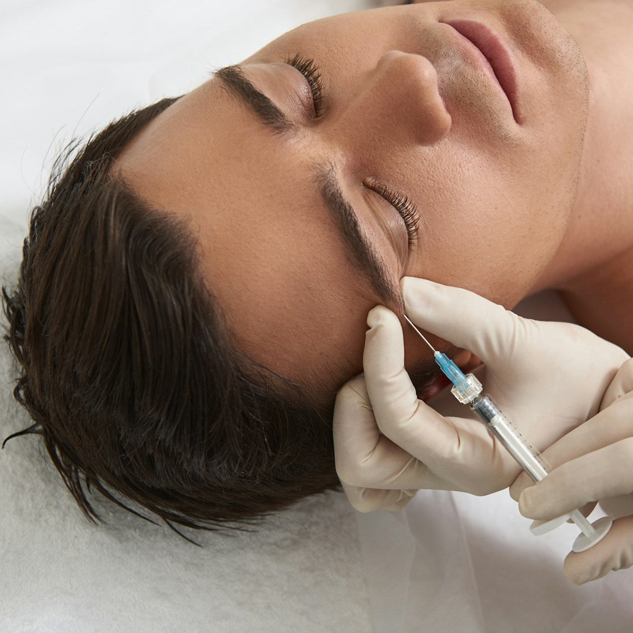 Dermal Filler Treatment Image 3