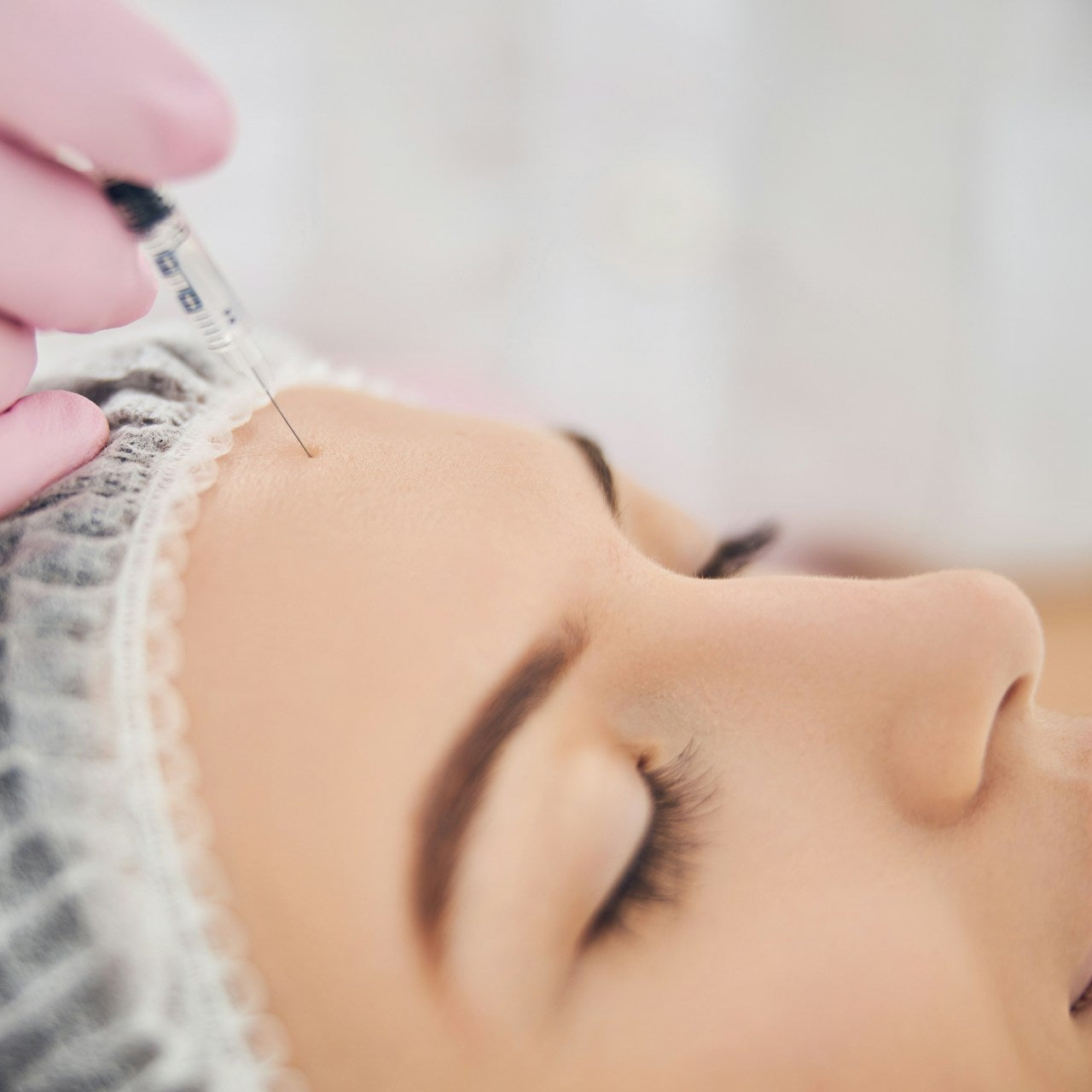 Ellanse Collagen Stimulant treatment Image 2
