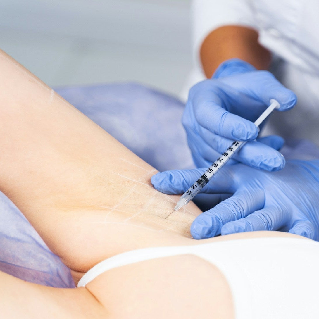 Excess Sweating Hyperhidrosis treatment Image 3