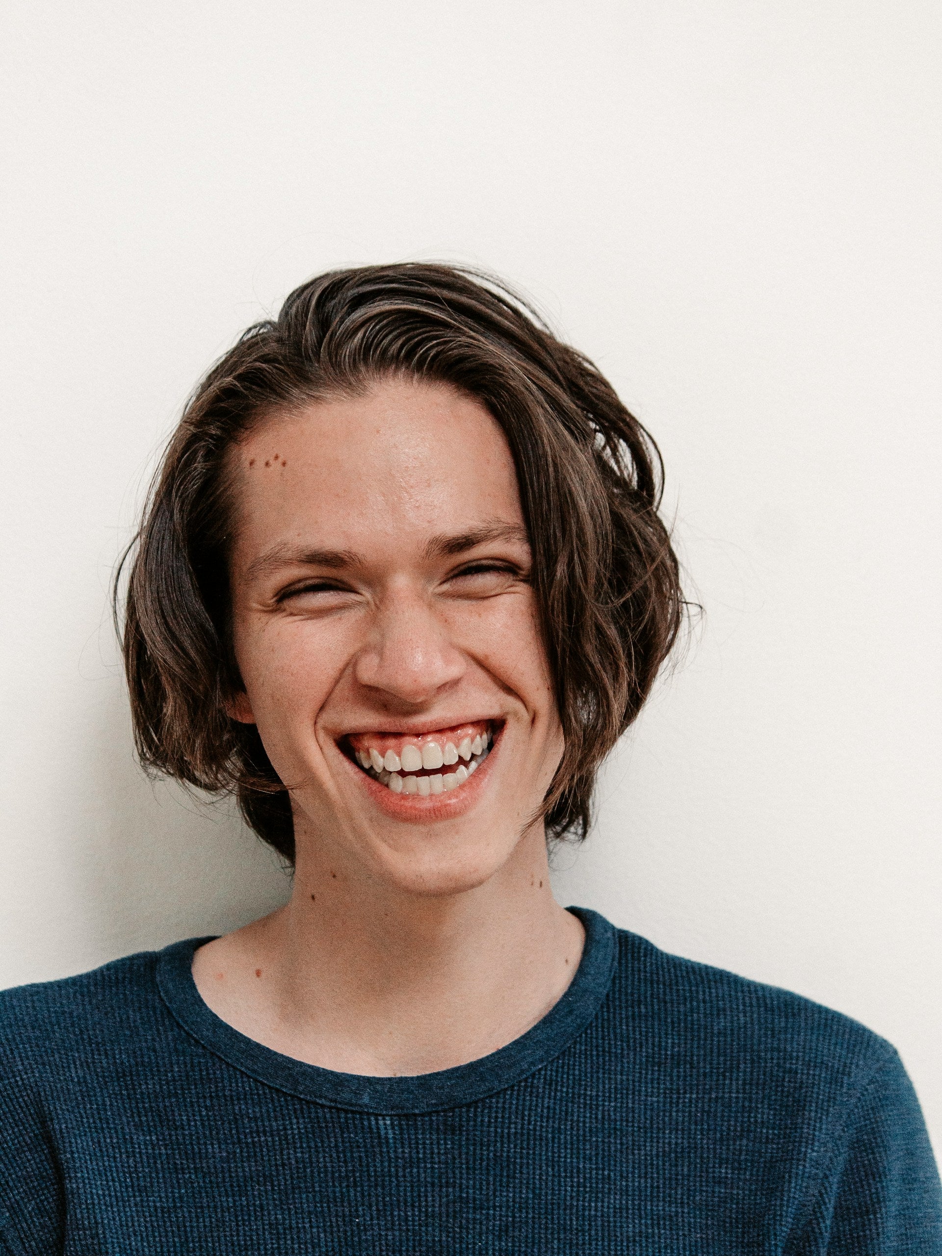 Gummy Smile Image 1