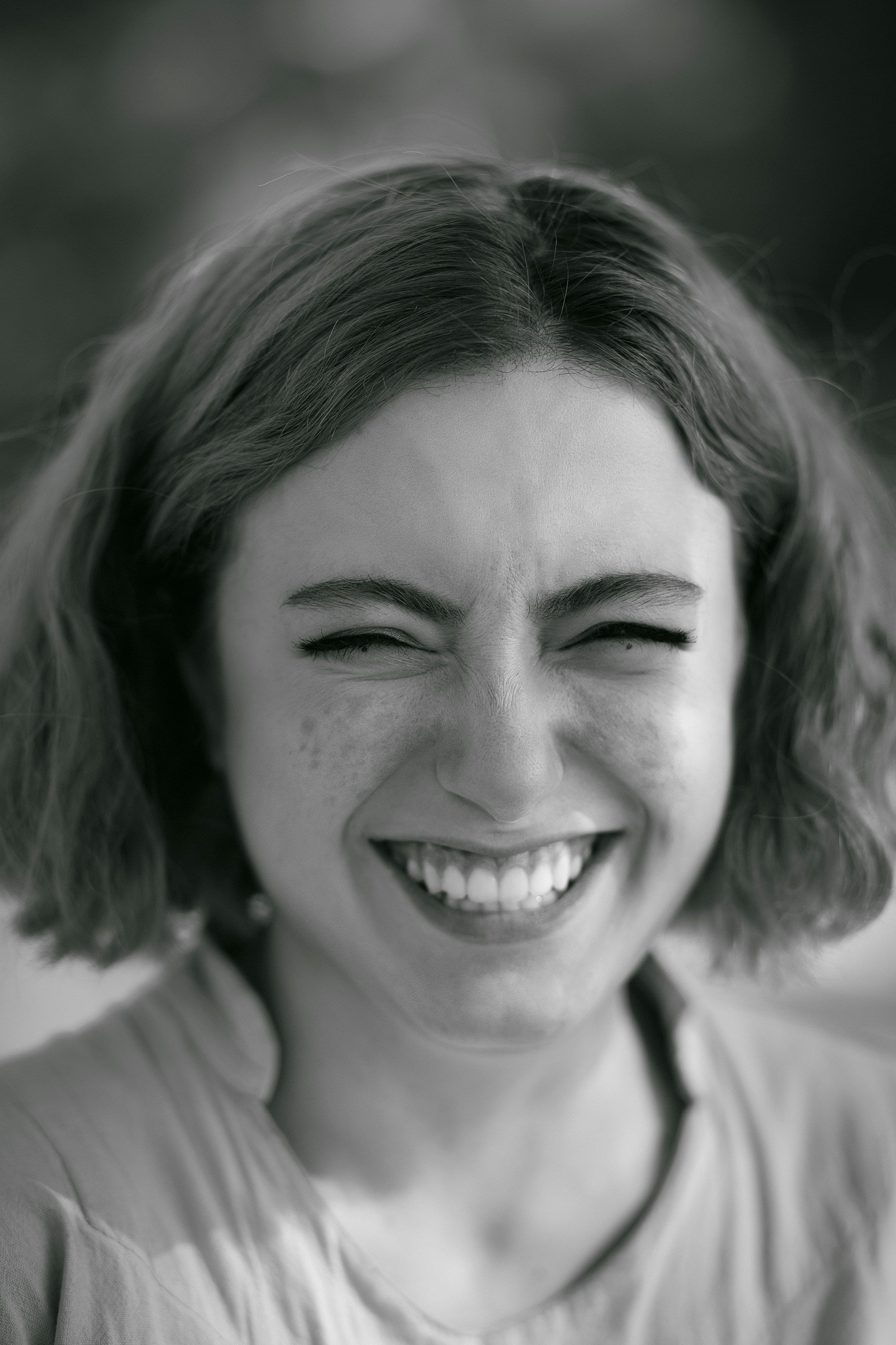 Gummy Smile Image 2