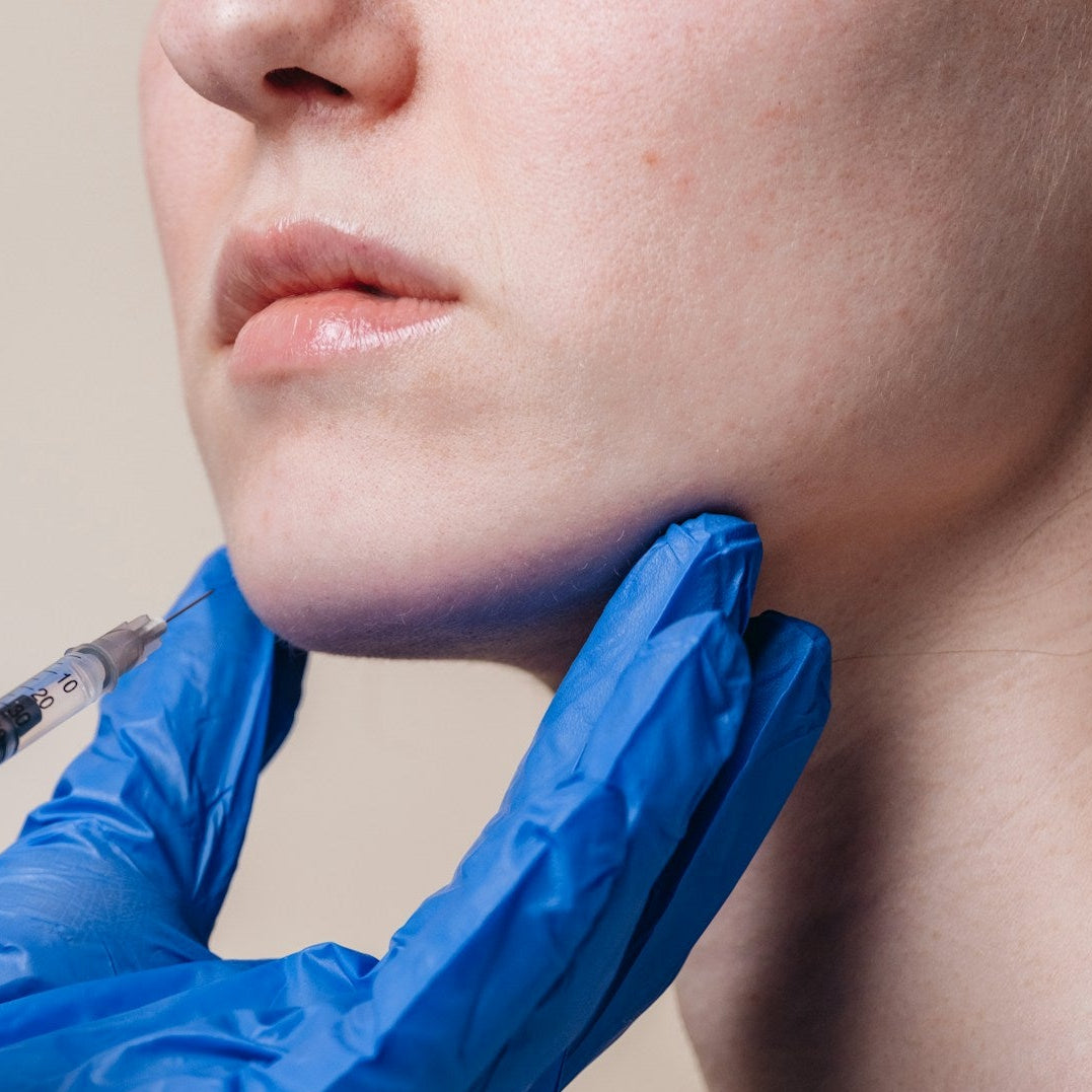 Jawline Filler Treatment image 1