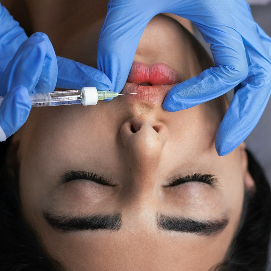 Lip filler Treatment Image 1