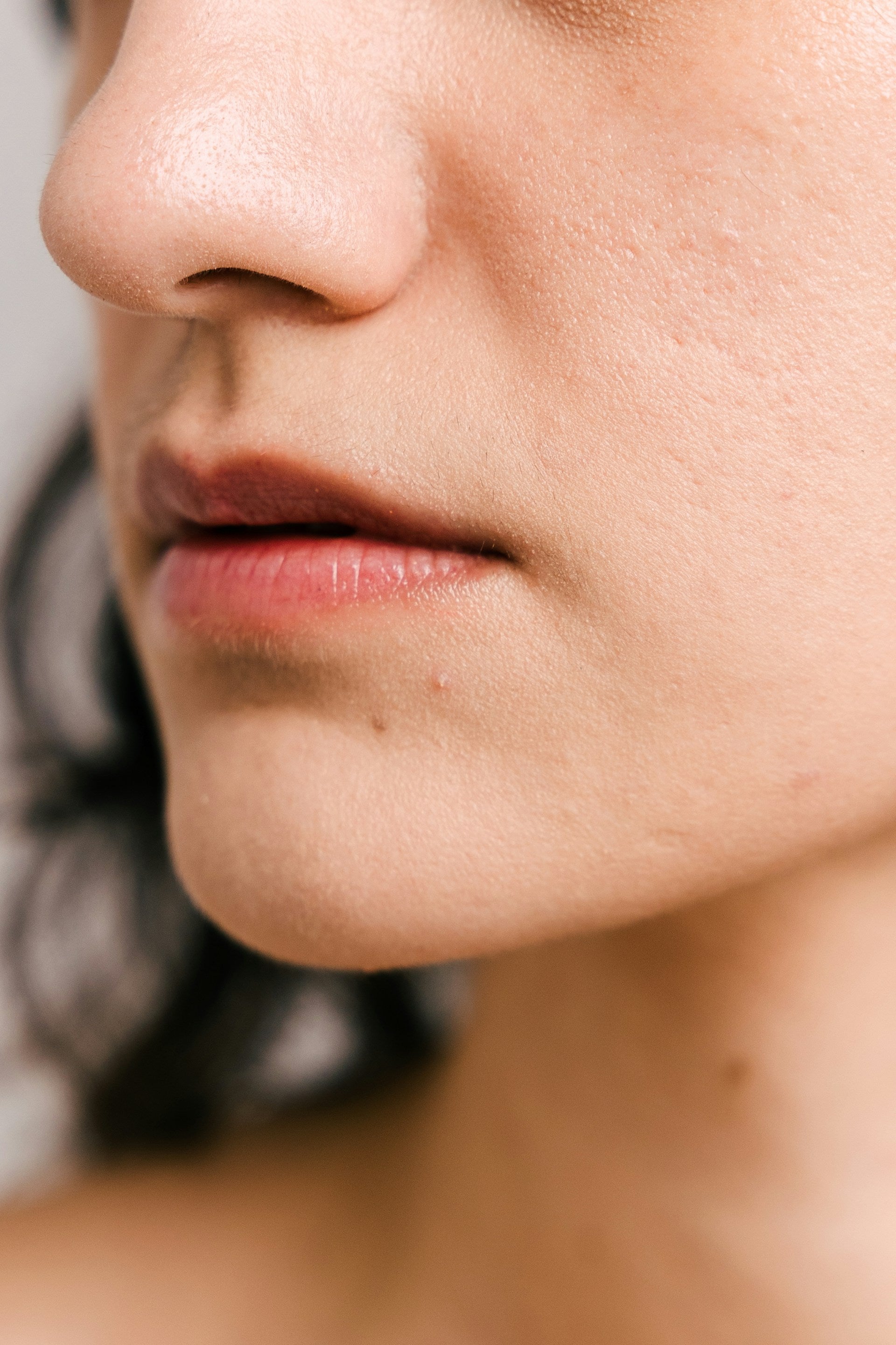 Lip Volume Loss Concern Image 2