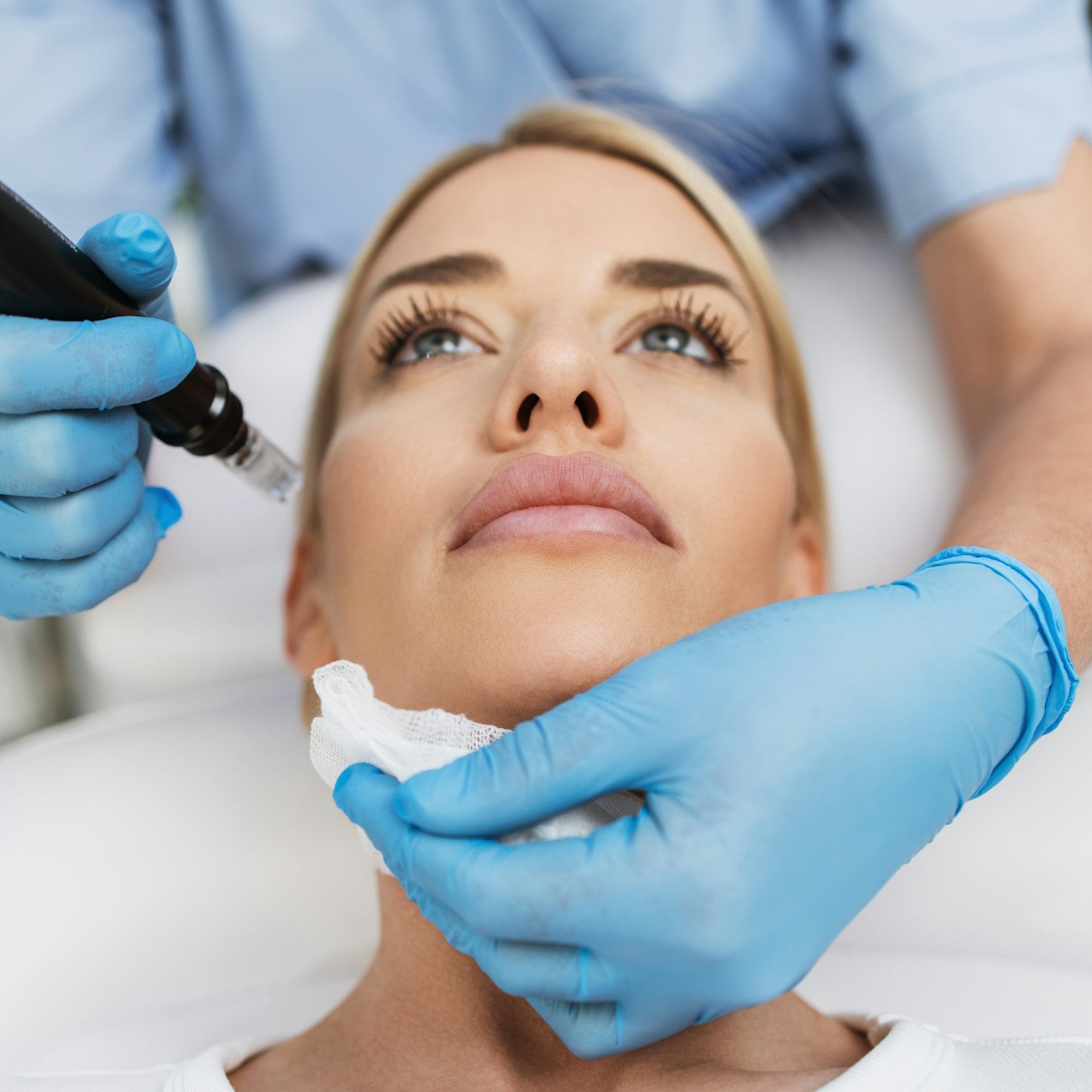 Microneedling Treatment Image 1