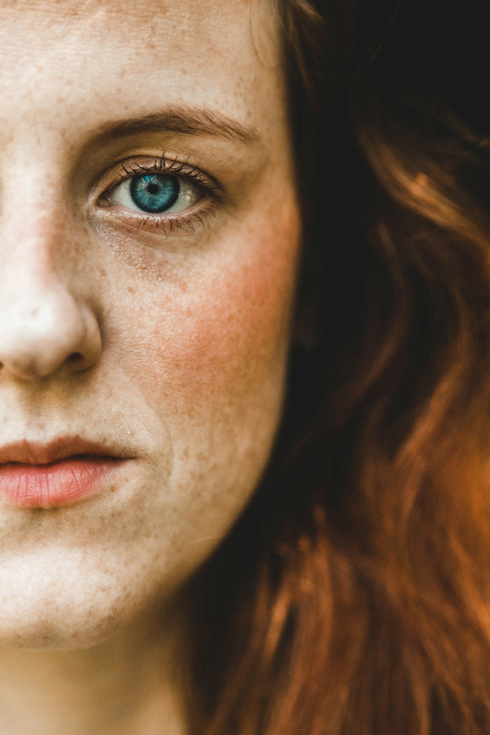Rosacea Redness Concern Image 1
