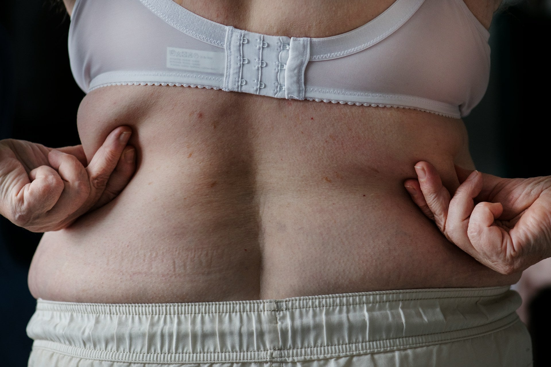 stubborn fat pocket concern 