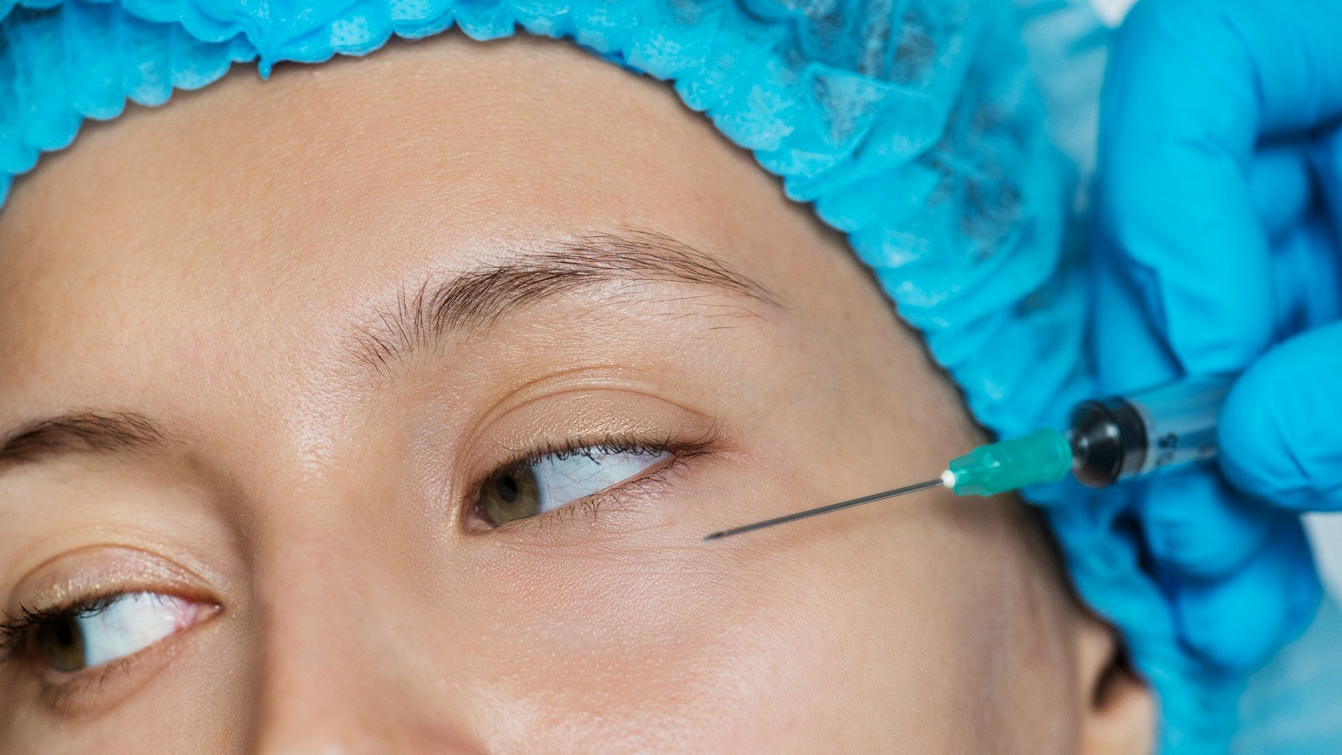 Tear Trough Filler Under Eye Filler Treatment