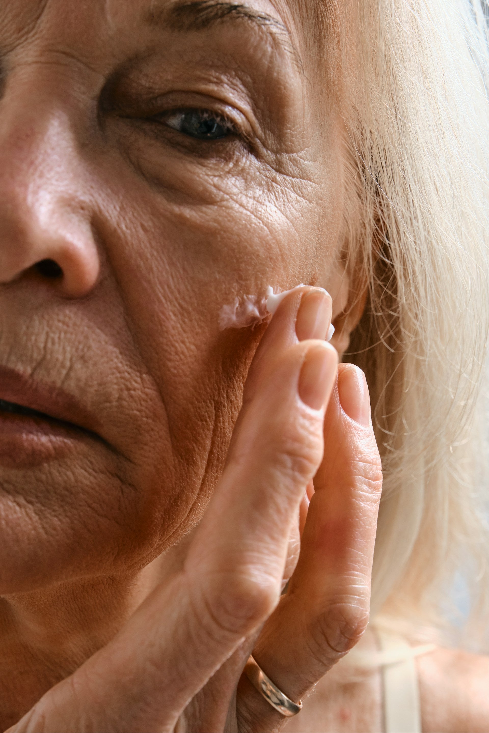 Wrinkle treatment Concern